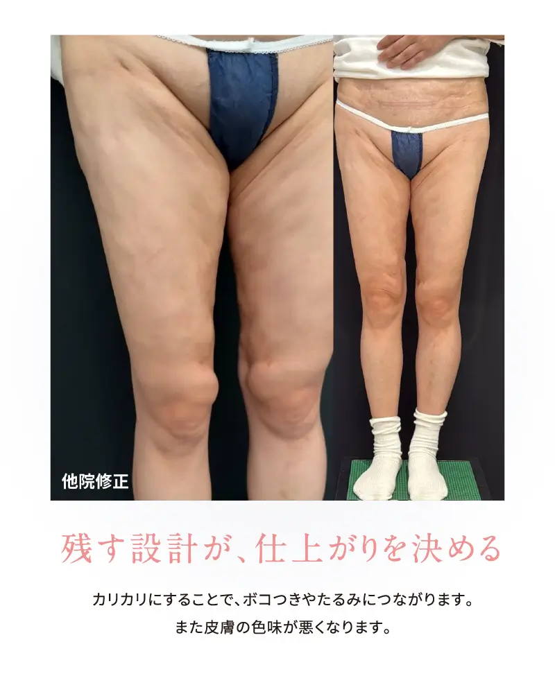 4D 残す設計が、仕上がりを決める