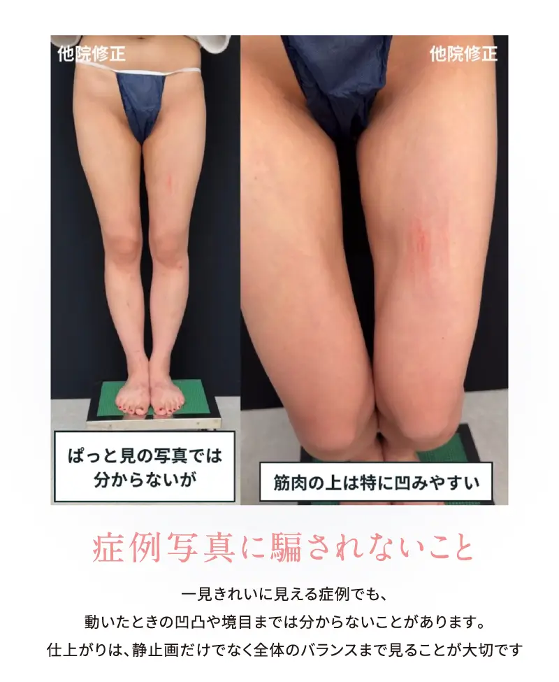 4D 静止画だけで判断しない