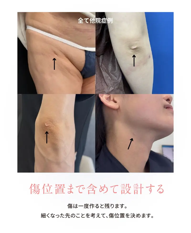 4D 修正症例を見てきたからわかること