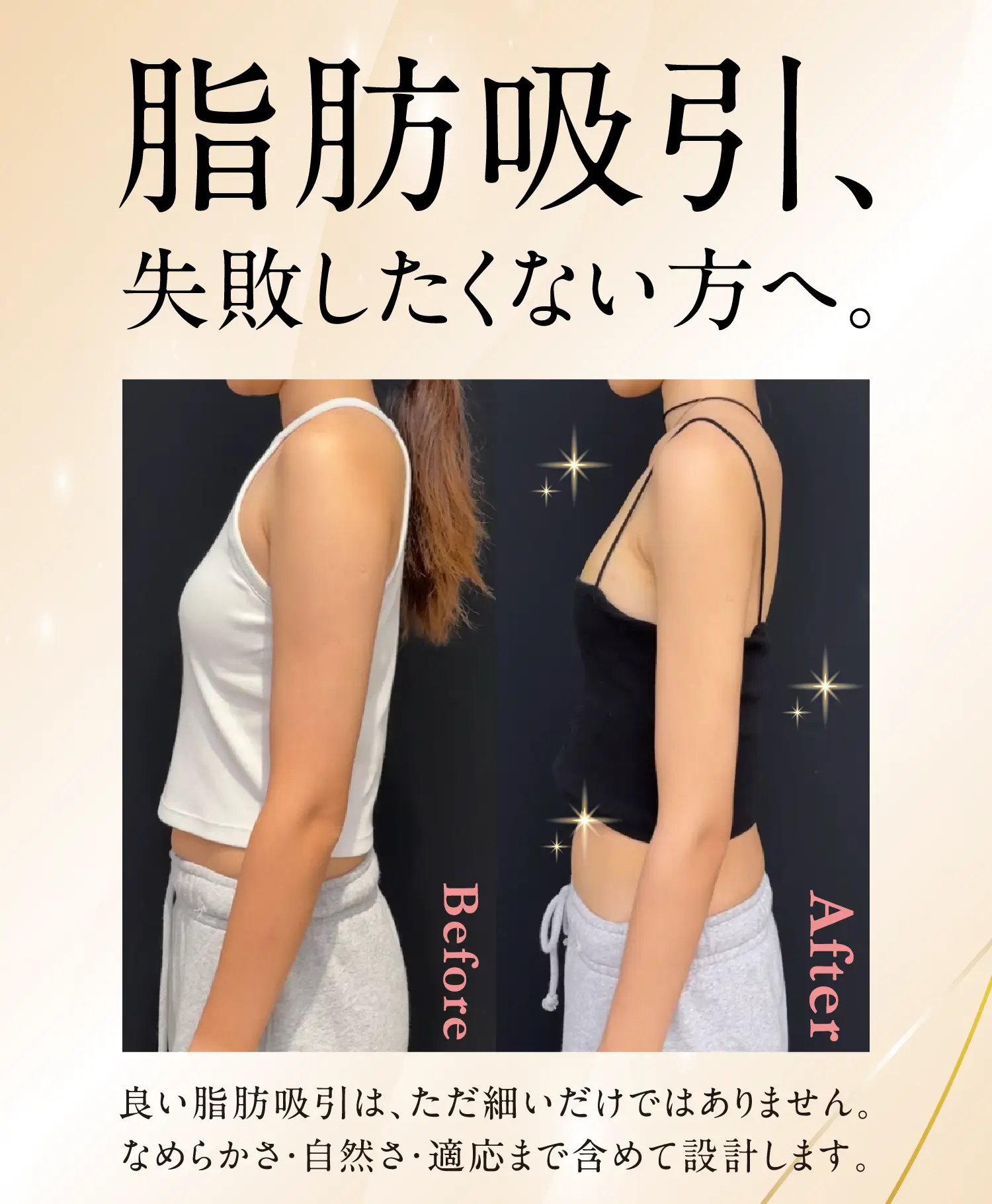 4D 脂肪吸引失敗したくない方へ。