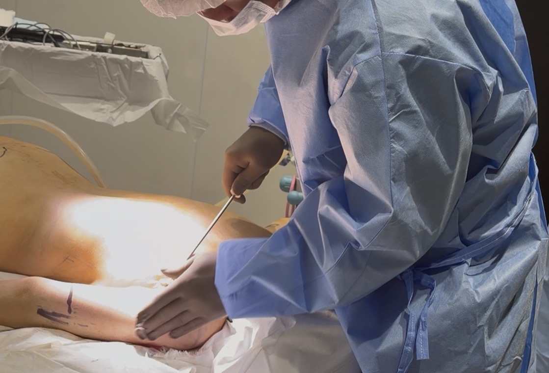 <br />
<b>Warning</b>:  Undefined variable $image_alt in <b>/home/r9092703/public_html/4dclinic.jp/wp/wp-content/themes/4d-clinic/single-price.php</b> on line <b>402</b><br />
