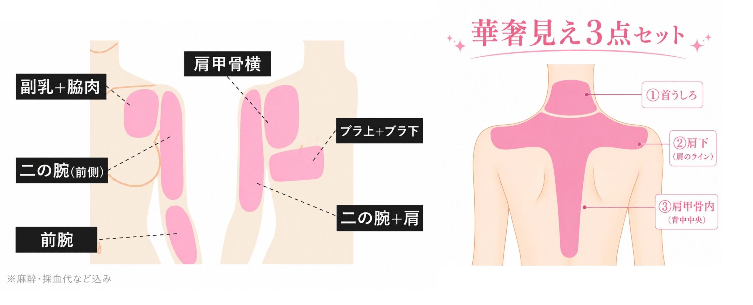 <br />
<b>Warning</b>:  Undefined variable $img_alt in <b>/home/r9092703/public_html/4dclinic.jp/wp/wp-content/themes/4d-clinic/single-price.php</b> on line <b>359</b><br />
