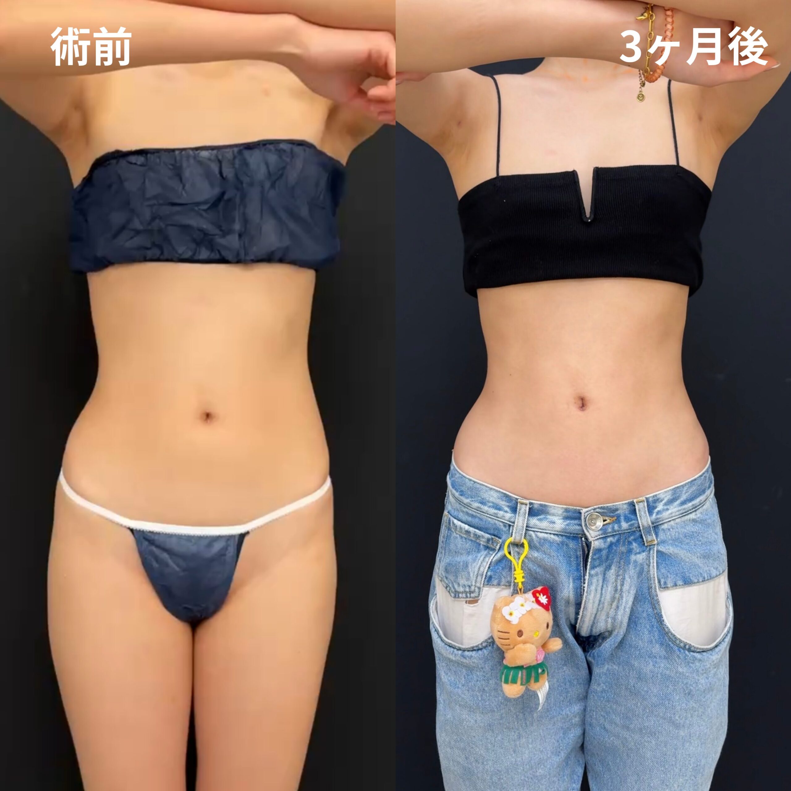 腹部全面・ウエスト・腰