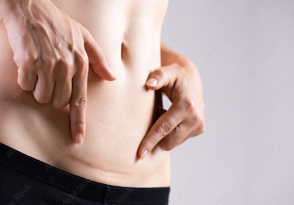 <br />
<b>Warning</b>:  Undefined variable $image_alt in <b>/home/r9092703/public_html/4dclinic.jp/wp/wp-content/themes/4d-clinic/single-price.php</b> on line <b>200</b><br />
