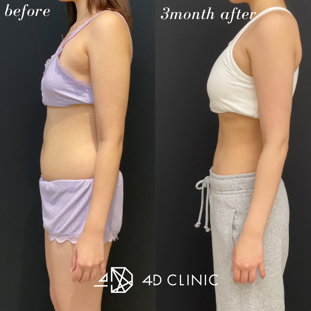 <br />
<b>Warning</b>:  Undefined variable $image_alt in <b>/home/r9092703/public_html/4dclinic.jp/wp/wp-content/themes/4d-clinic/single-case.php</b> on line <b>108</b><br />
