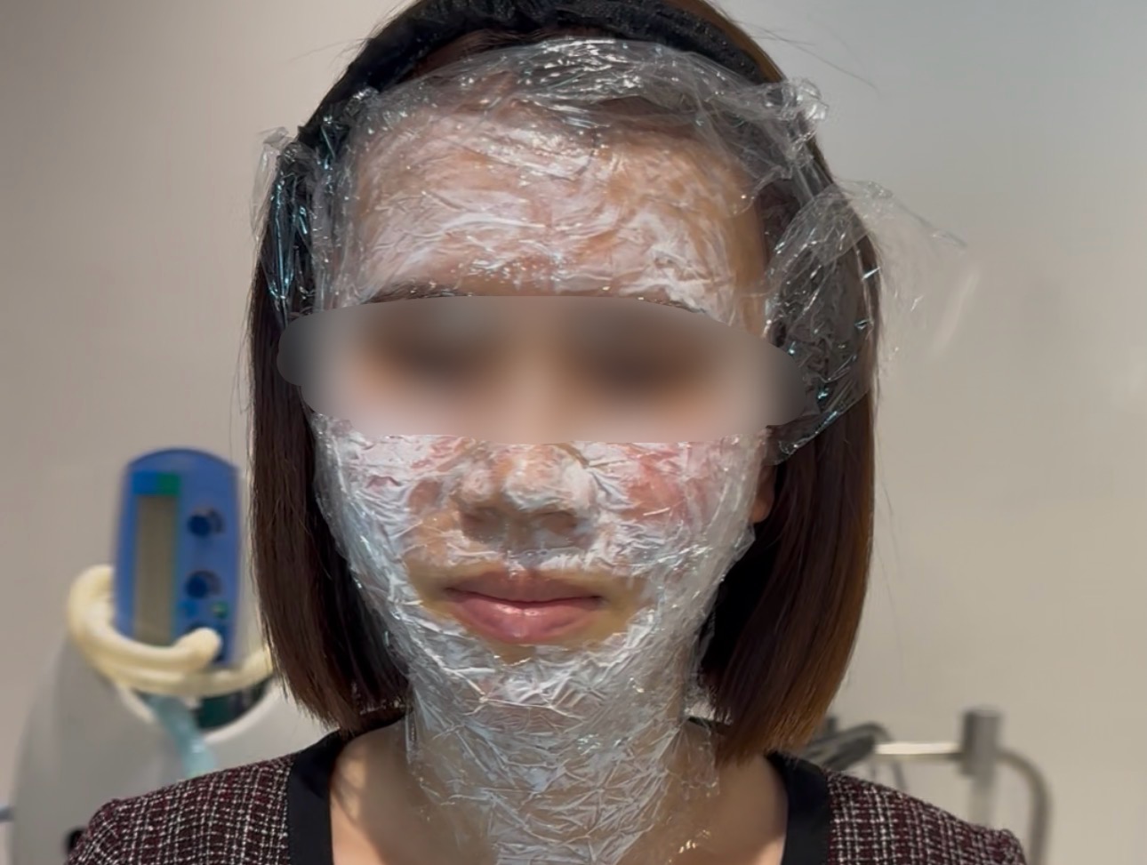 <br />
<b>Warning</b>:  Undefined variable $image_alt in <b>/home/r9092703/public_html/4dclinic.jp/wp/wp-content/themes/4d-clinic/single-price.php</b> on line <b>402</b><br />
